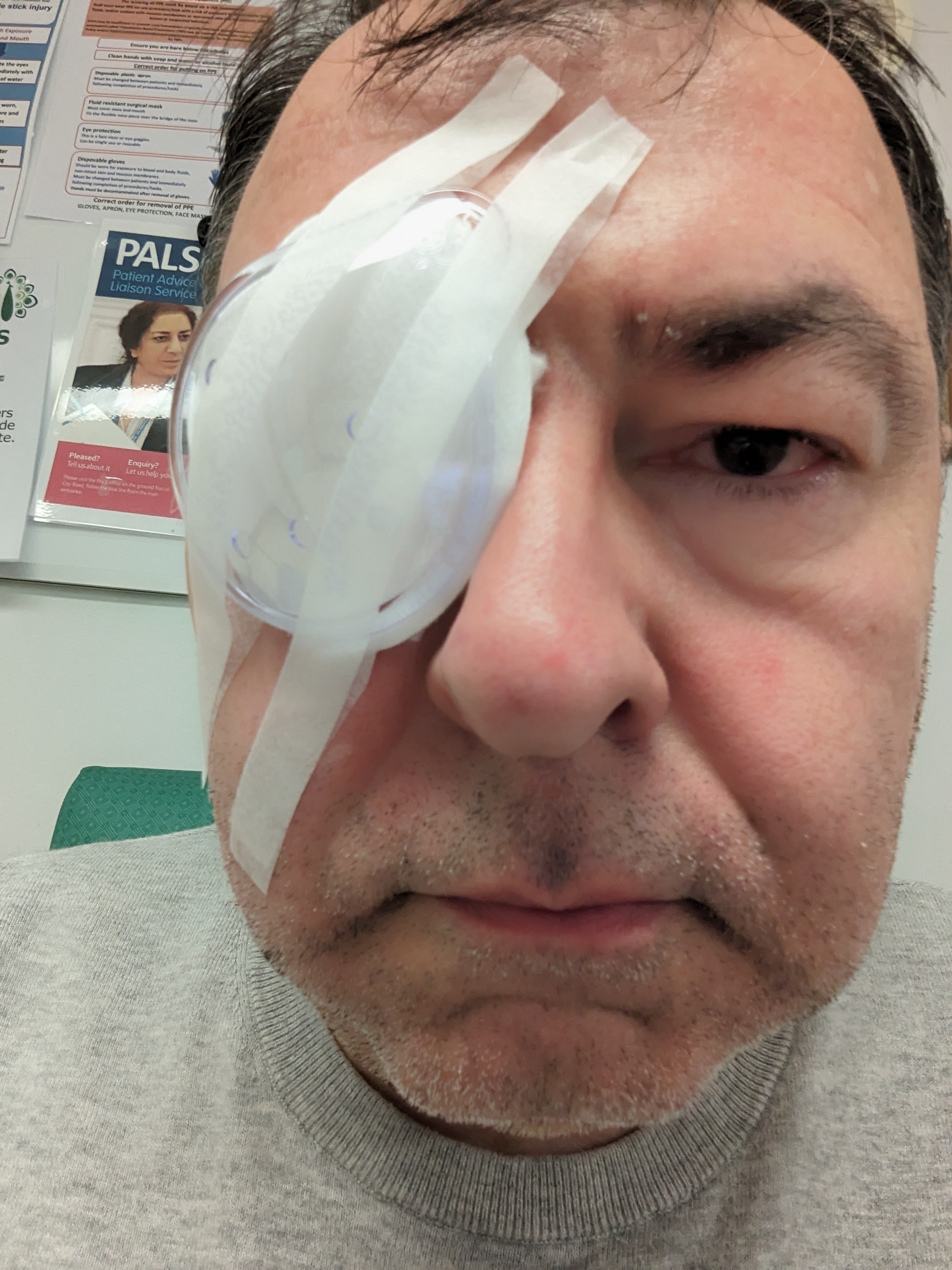 Andrew Jacobs with a patch over his right eye